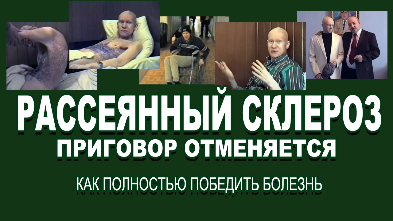 Лютеолин в лечении рассеянного склероза Лютеолин в лечении рассеянного склероза