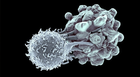 Методы оксидативного (окислительного) стресса для лечения раковых опухолей повышают эффективность методик вызывающих апоптоз онкоклеток