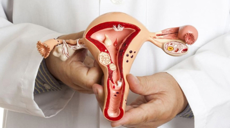 Рак шейки матки и суть предлагаемого лечения